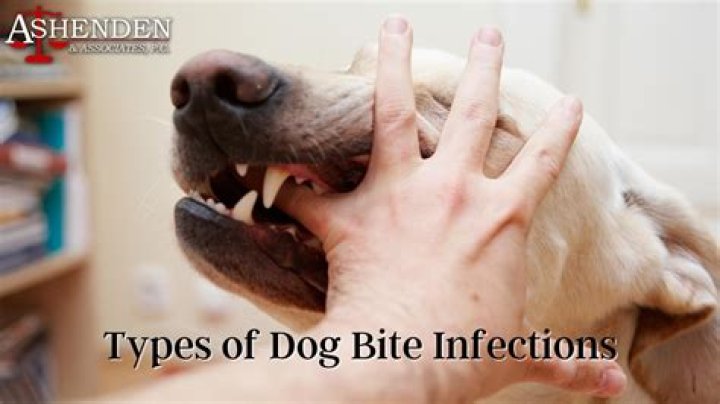 Question: How To Make A Homemade Dog Bite Sleeve